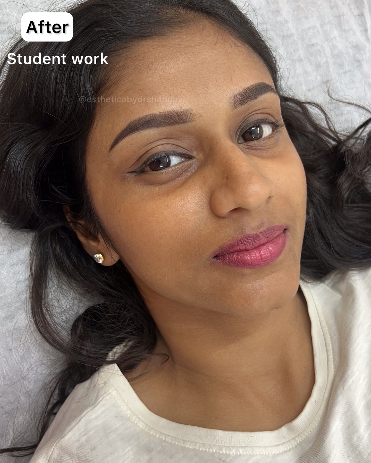 Eyebrow microblading Bangalore by Dr. Shangavi