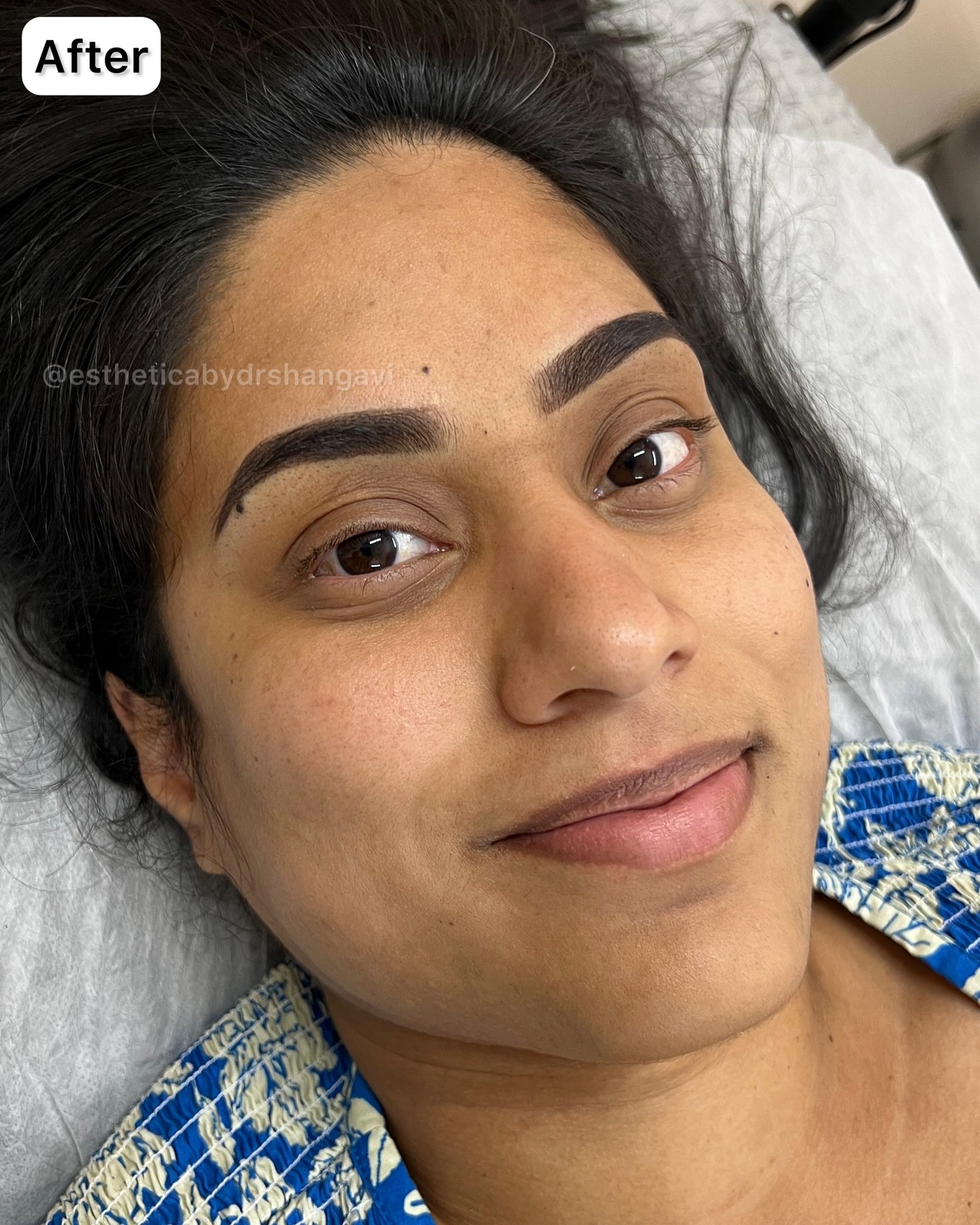 Microblading eyebrows cost in Bangalore - natural results