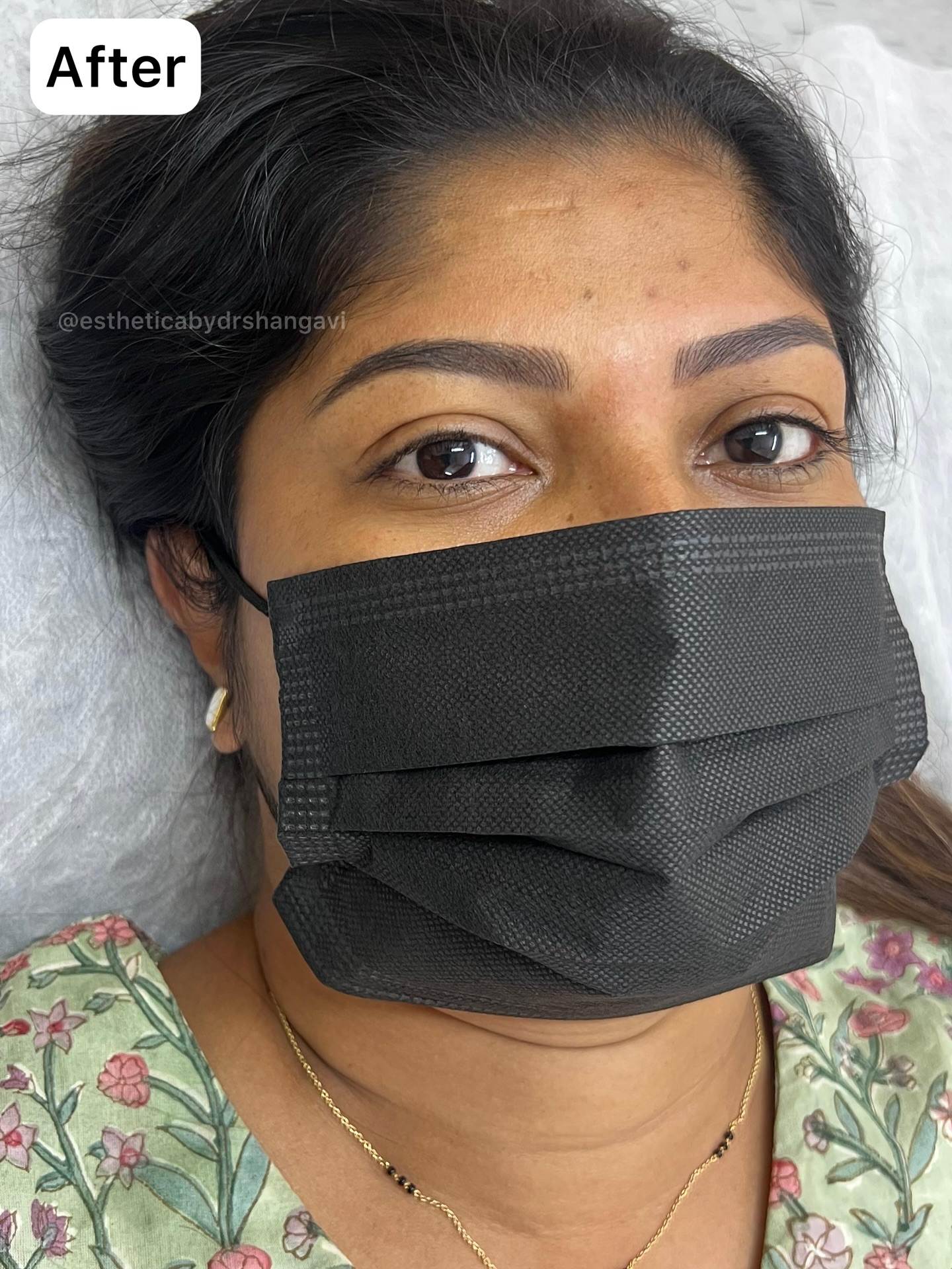 Permanent eyebrows Bangalore