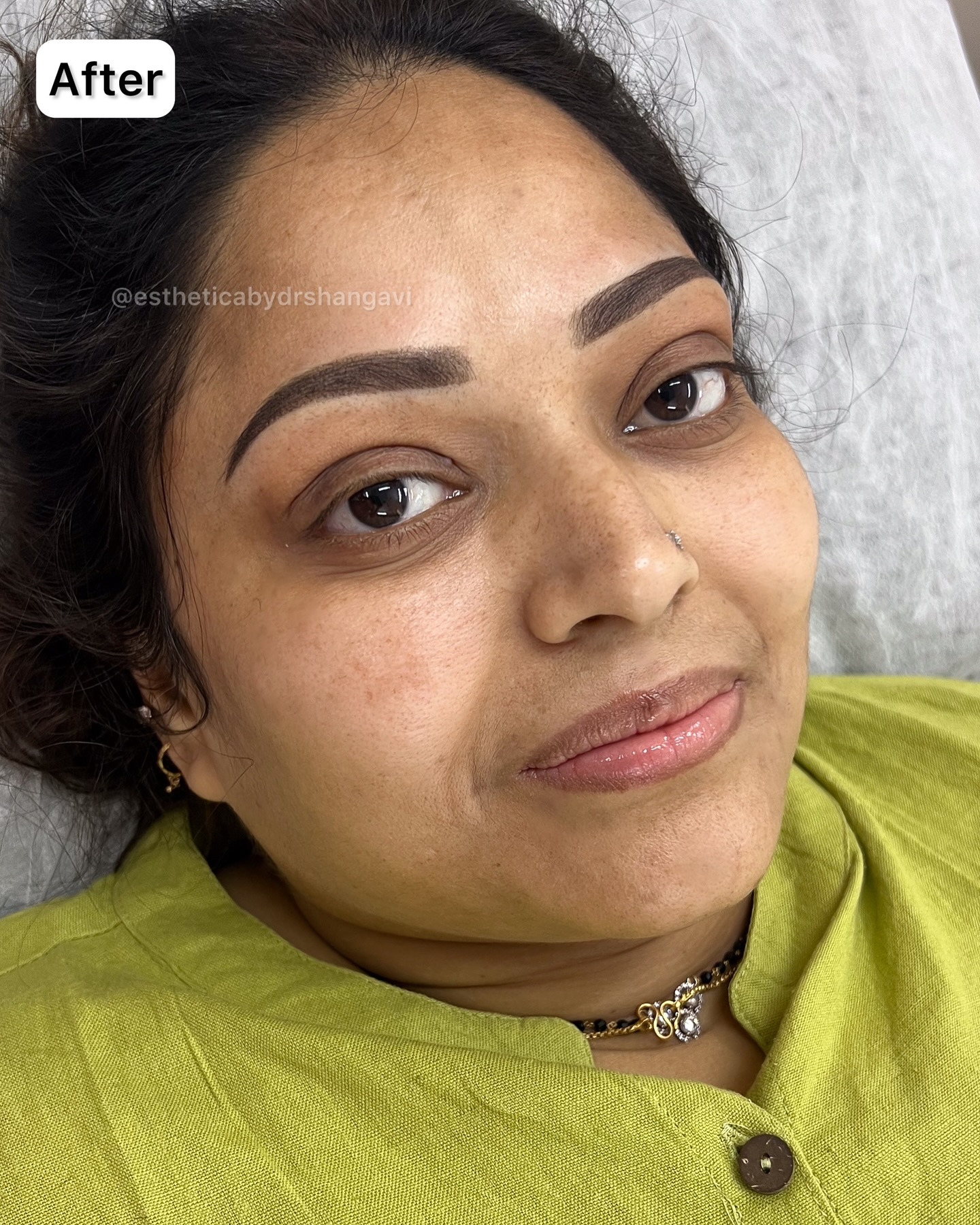 Elite microblading results Bangalore